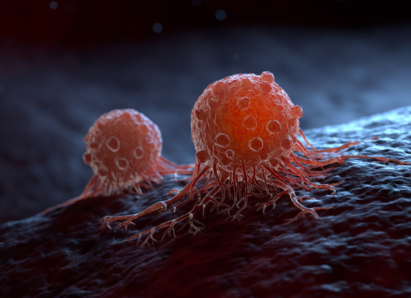 New cancer therapy will improve efficacy by injecting chemo at present into tumor cells