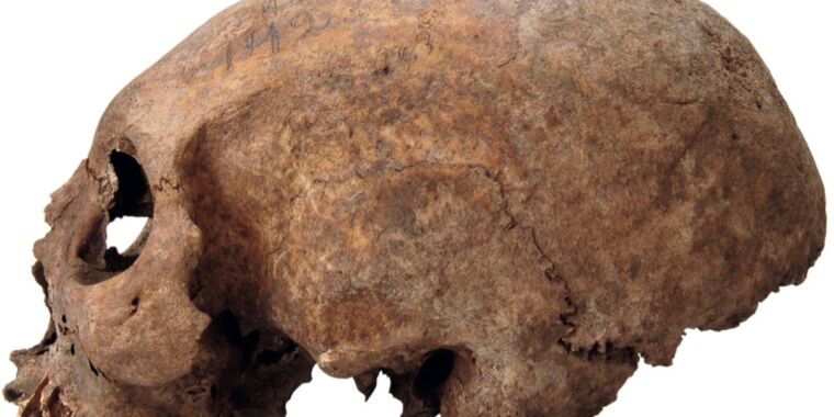 Watch: Three skulls of medieval Viking women had been intentionally elongated